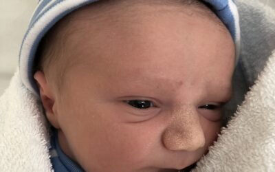 “It was so different from the first time. I’m sure if it wasn’t for TCBS I’d have ended up down a much more medicalised route.”